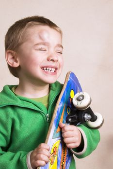 Young boy with a bump on his head after falling