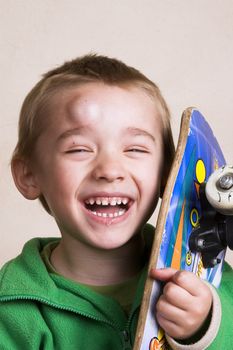 Young boy with a bump on his head after falling