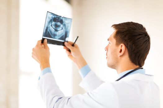 picture of male doctor or dentist looking at x-ray