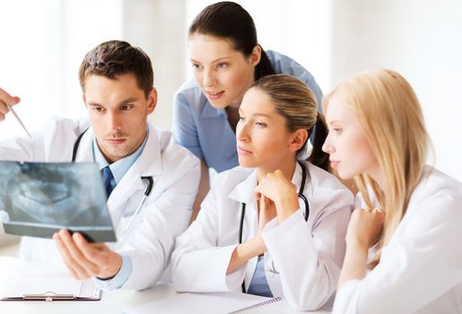 healthcare, medical and radiology concept - group of doctors looking at x-ray