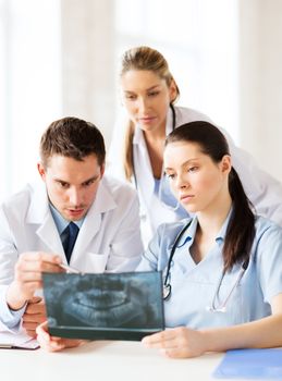 healthcare, medical and radiology concept - group of doctors looking at x-ray