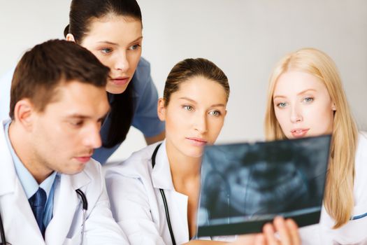 healthcare, medical and radiology concept - group of doctors looking at x-ray