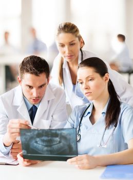 healthcare, medical and radiology concept - group of doctors looking at x-ray