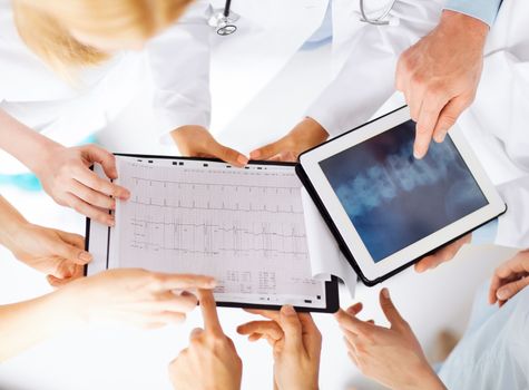 healthcare, hospital and medical concept - group of doctors looking at x-ray on tablet pc