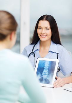 healthcare, medicine, radiology and technology concept - female smiling doctor or nurse showing x-ray on tablet pc