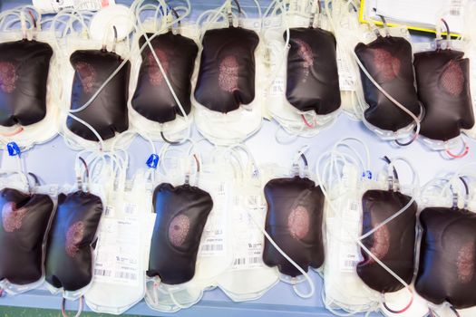 Blood bags before the separation procedure where blood components are separated and processed for transfusion.