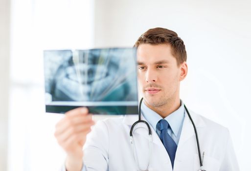 medicine and healthcare concept - concerned male doctor or dentist looking at x-ray in hospital