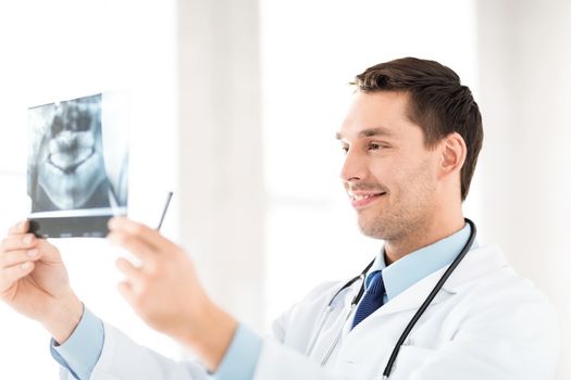 picture of male doctor or dentist with x-ray