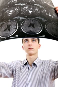 Worried Teenager holding x-ray scan on the white background