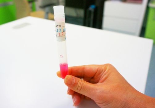 Substances used for culturing bacteria in vitro.
Used in medical.                             