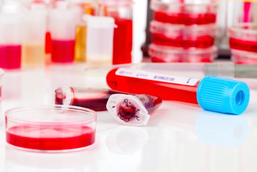 Blood sample in a test tube