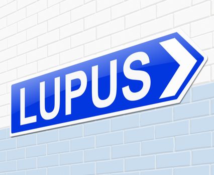 Illustration depicting a sign with a Lupus concept.