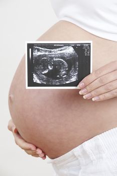 Close Up Of Pregnant Woman Holding Ultrasound Scan