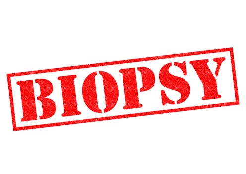 BIOPSY red Rubber Stamp over a white background.