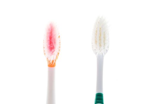 Two Color worn toothbrush on white background