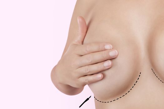 Perfect breast. Aesthetic medicine. Beautiful girl touching her breast with plastic surgery marks. Feminine beauty. 
