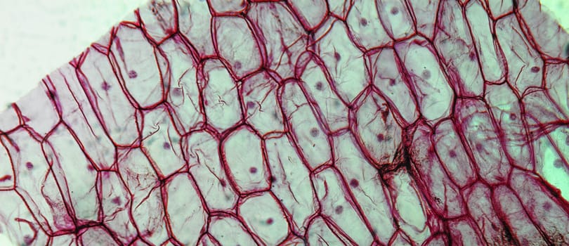 Light photomicrograph of an Onion epidermus seen through a microscope