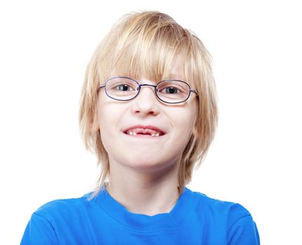 portrait of a boy with glasses showing his first missing milk teeth