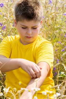 Boy with an allergy to the hands