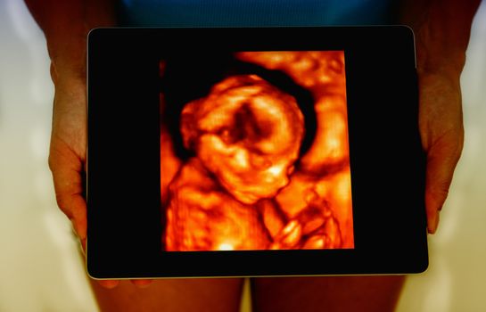 Woman holding tablet pc. Concept: Ultrasound image of baby in mother's womb. Isolated on white.