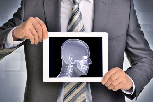 Man hands using tablet pc. Image of x-ray head on tablet screen