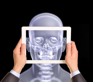 Man hands using tablet pc. Image of x-ray head on tablet screen