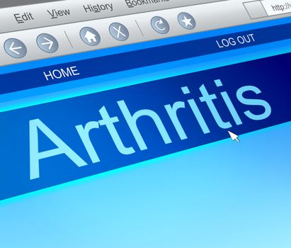 Illustration depicting a computer screen capture with an arthritis concept.