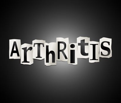 Illustration depicting a set of cut out printed letters arranged to form the word Arthritis.
