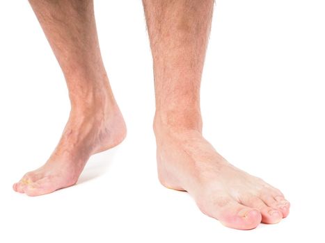 Male person with hairy legs, walking barefooted towards, against white background