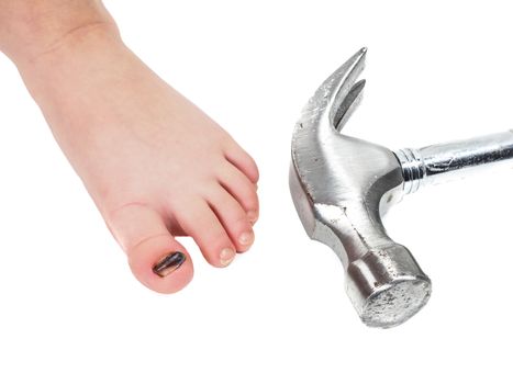 Child showing blue toenail barefoot next to shining steel hammer head isolated on white