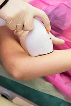 Laser epilation or photo epilation of woman hand
