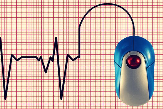 an electrocardiogram (ECG) depicted by computer mouse cable