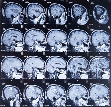 CT computer tomography scan image