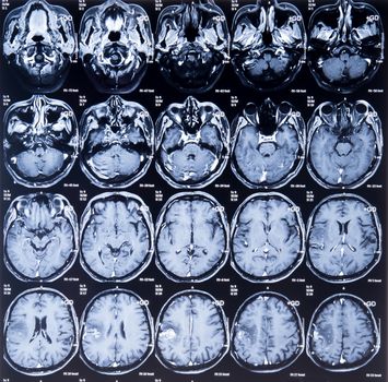 CT computer tomography scan image