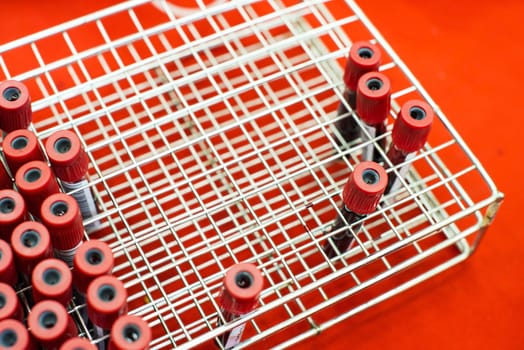 Rack of tubes with blood samples, laboratory microscope and laboratory