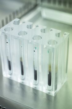 Medical laboratory preparation of human growth factors in hospital clinic for orthopedic surgery and Traumatology rehabilitation treatment with test tubes in sterile environment.