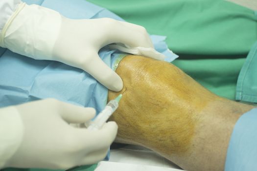 Close-up color photo of a female hospital clinic operating theater room surgeon wearing sterile blue gloves and senior male patient aged 65-70 receiving a an injection of human growth factors in his knee with sterilising liquid and sterile green hospital bed defocused background.