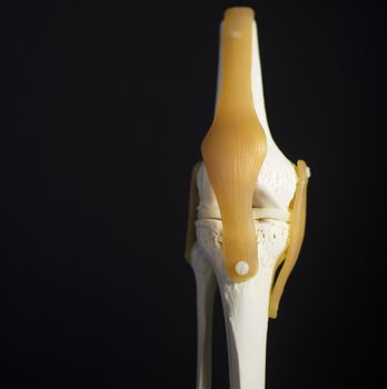 Medical knee joint meniscus plastic demonstration teaching model against plain black studio background. The knee joint meniscus femur thigh bone and tibia shin traumatology medical plastic model is used to show articulation and possible injuries to human bone or tissue in demostrations and university lectures for students of medicine and surgery. 
