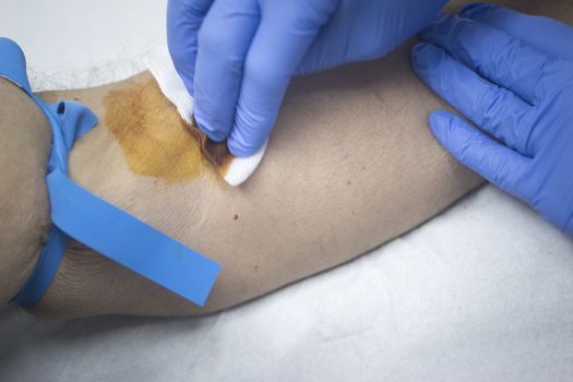 Close-up color photo of a female hospital clinic nurse wearing sterile blue gloves and senior male patient aged 65-70 giving a blood donation sample from the interior of his elbow resting arm on sterile blue white defocused background.