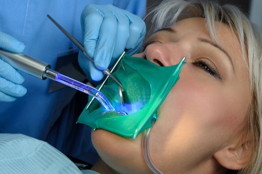 dentist at work with patient, using of dental curing light