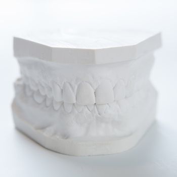 Dental casting gypsum model plaster cast stomatologic human jaws prothetic laboratory, technical shots