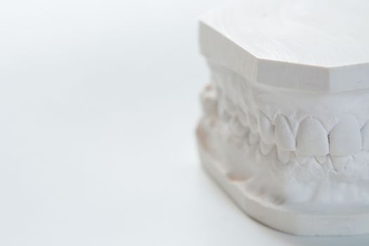 Gypsum model of human jaw on a white background. Selective Focus