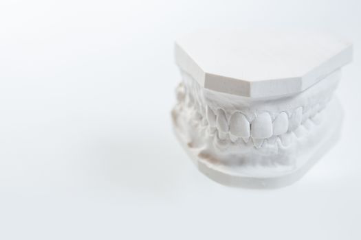 Dental casting gypsum model plaster cast stomatologic human jaws prothetic laboratory, technical shots