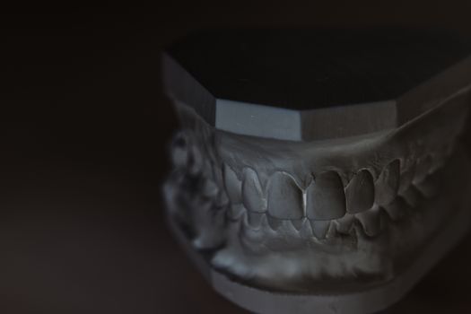 Gypsum model of human jaw on a white background. Selective Focus