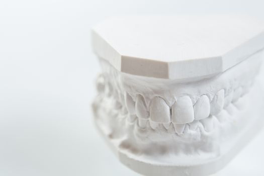 Dental casting gypsum model plaster cast stomatologic human jaws prothetic laboratory, technical shots