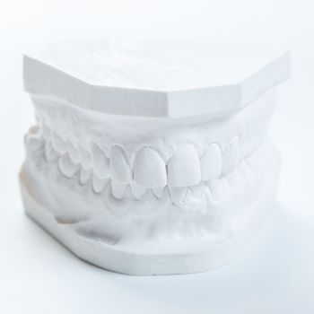 Dental casting gypsum model plaster cast stomatologic human jaws prothetic laboratory, technical shots