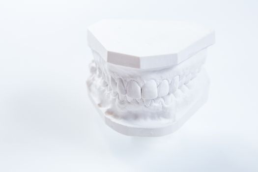 Gypsum model of human jaw on a white background. Selective Focus