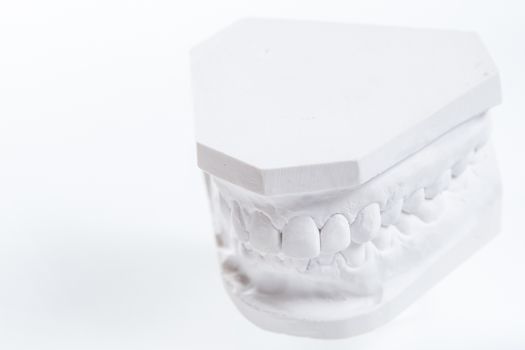 Gypsum model of human jaw on a white background. Selective Focus