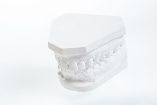 Dental casting gypsum model plaster cast stomatologic human jaws prothetic laboratory, technical shots