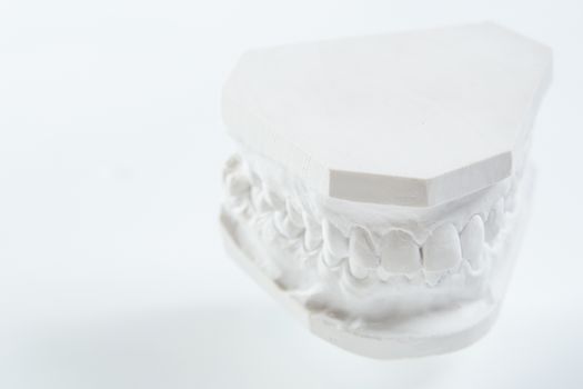 Dental casting gypsum model plaster cast stomatologic human jaws prothetic laboratory, technical shots